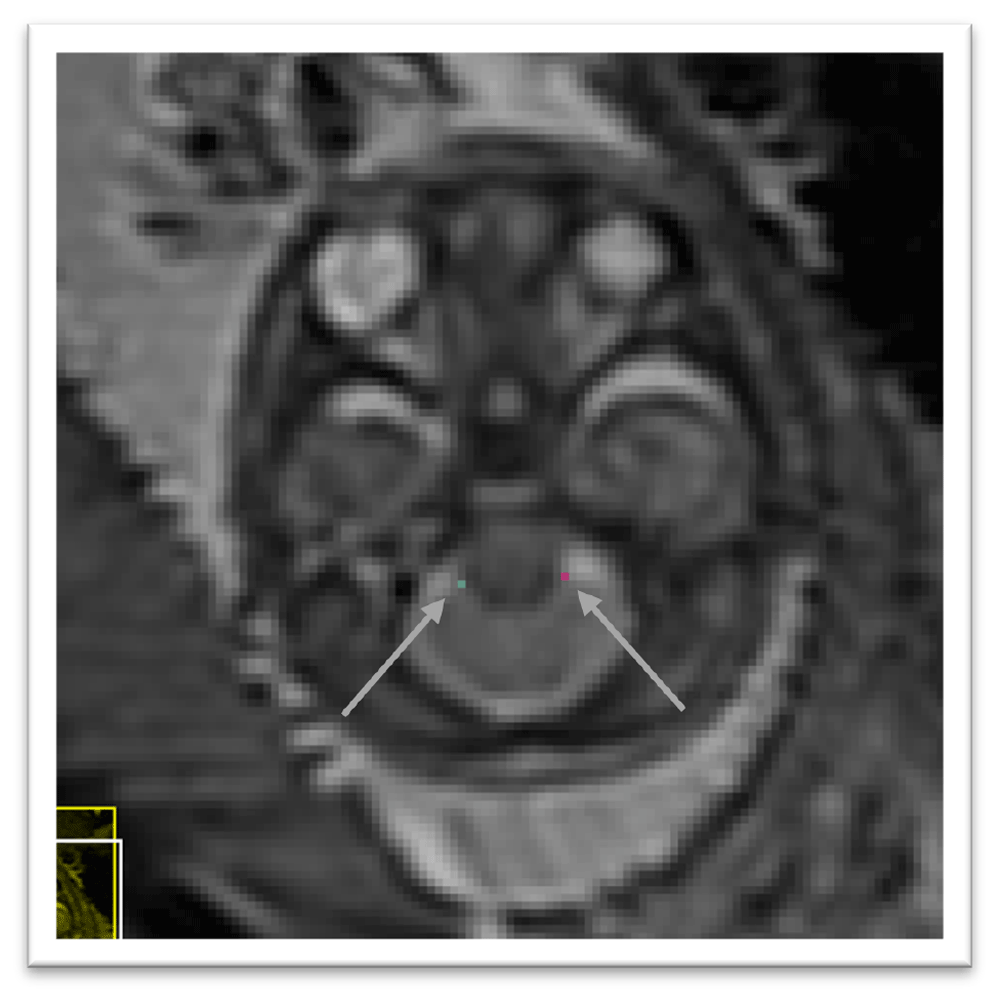 22cbbf00-1b02-45de-b6b4-2d07ed25533e_figure6.gif