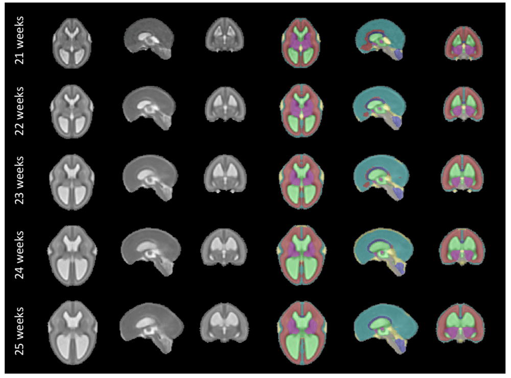 22cbbf00-1b02-45de-b6b4-2d07ed25533e_figure11.gif