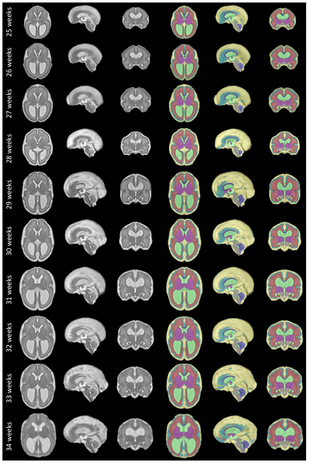 22cbbf00-1b02-45de-b6b4-2d07ed25533e_figure12.gif