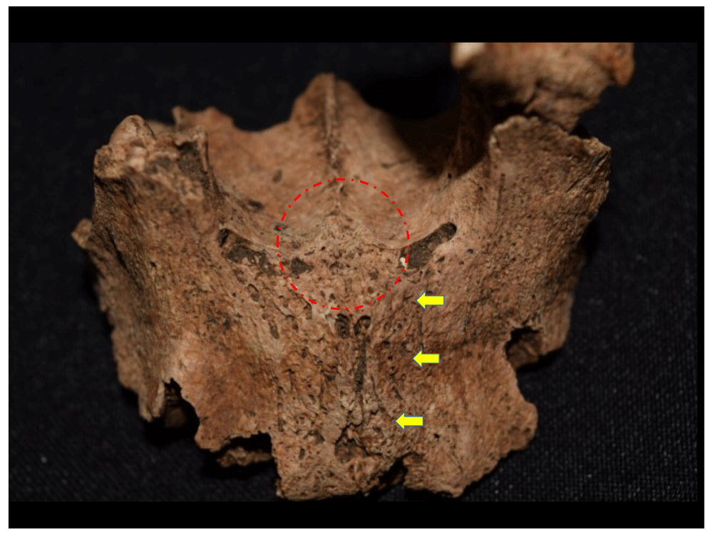12afbf35-1783-44db-b708-10d1394df588_figure32.gif