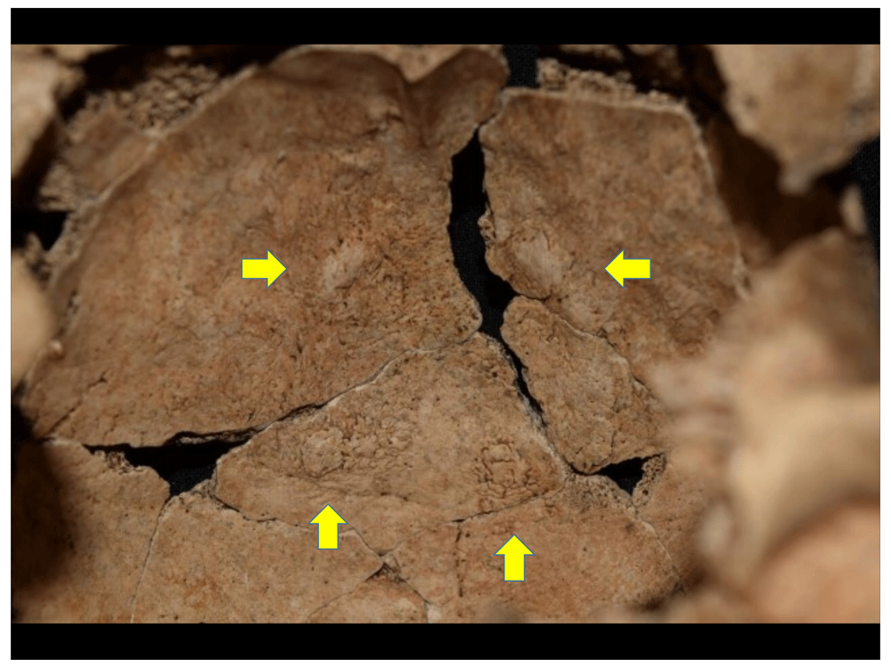 12afbf35-1783-44db-b708-10d1394df588_figure47.gif
