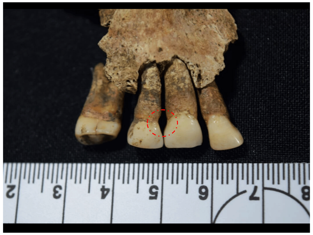 12afbf35-1783-44db-b708-10d1394df588_figure106.gif