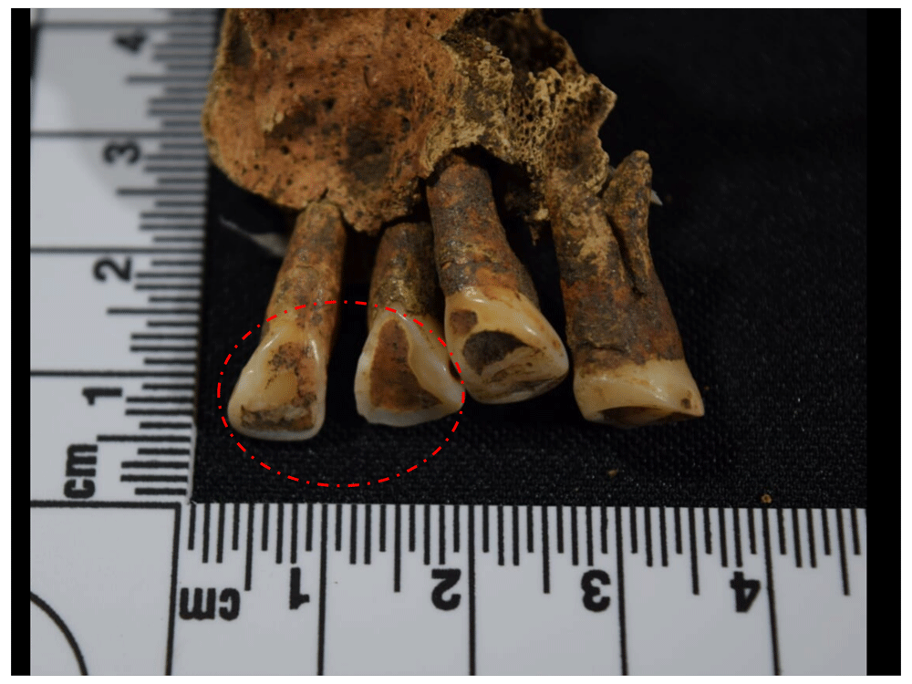 12afbf35-1783-44db-b708-10d1394df588_figure109.gif