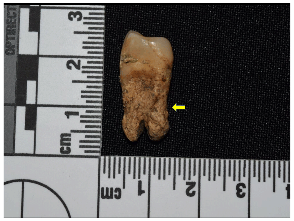 12afbf35-1783-44db-b708-10d1394df588_figure112.gif