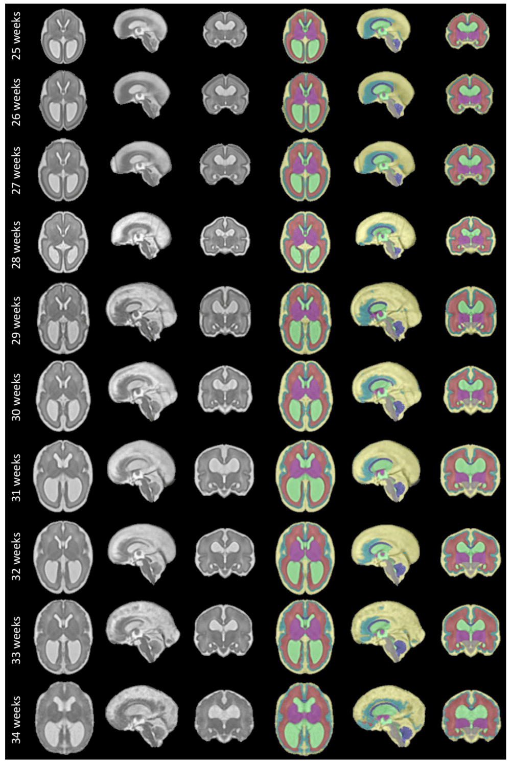 58f9748f-7756-4dd9-b24e-5c61abd70bee_figure10.gif
