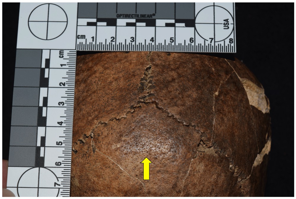 12afbf35-1783-44db-b708-10d1394df588_figure17.gif