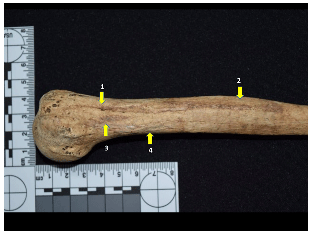 12afbf35-1783-44db-b708-10d1394df588_figure39.gif