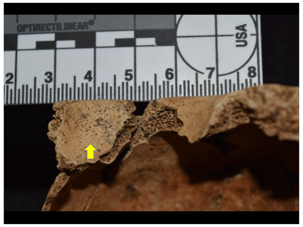 12afbf35-1783-44db-b708-10d1394df588_figure46.gif