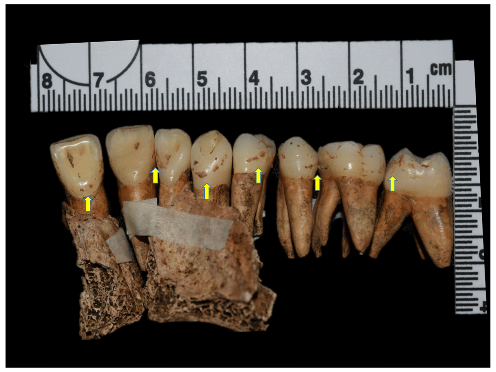 12afbf35-1783-44db-b708-10d1394df588_figure85.gif