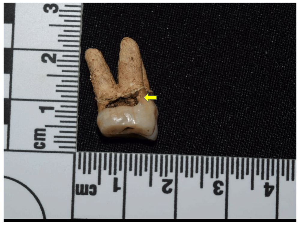 12afbf35-1783-44db-b708-10d1394df588_figure87.gif