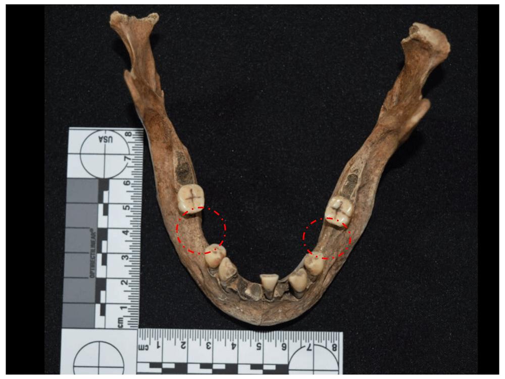 12afbf35-1783-44db-b708-10d1394df588_figure95.gif