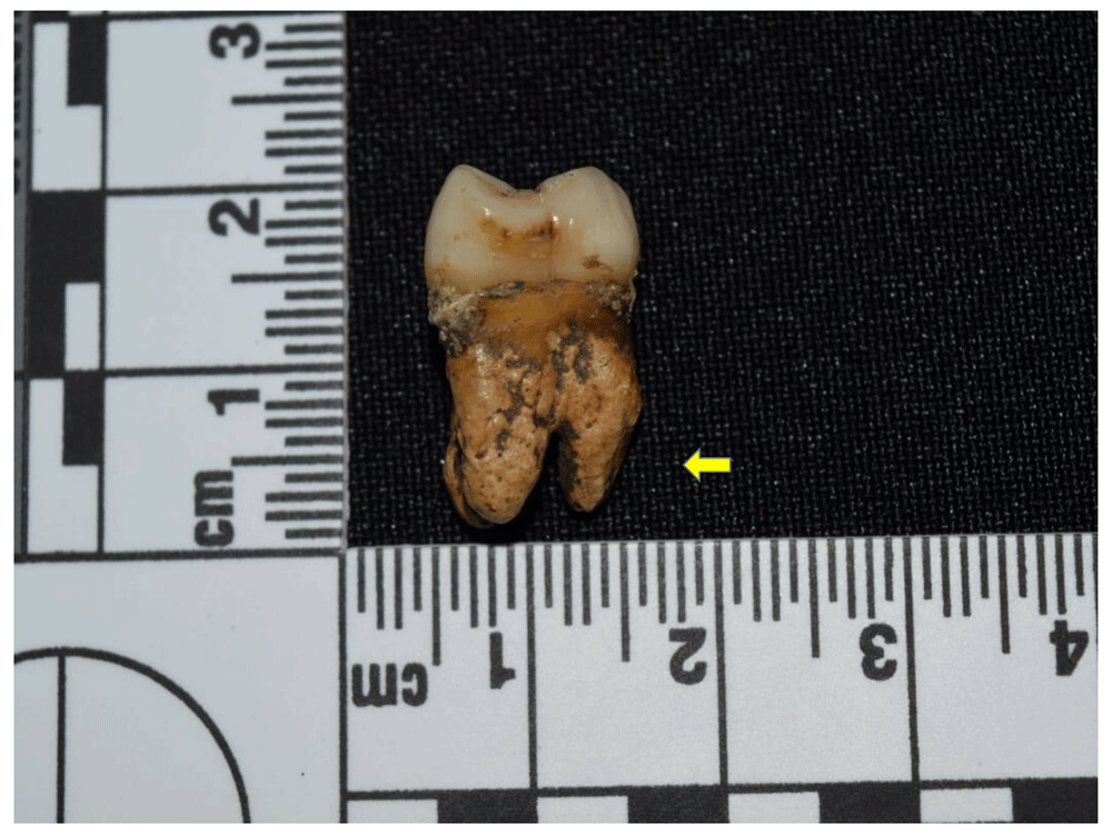 12afbf35-1783-44db-b708-10d1394df588_figure111.gif