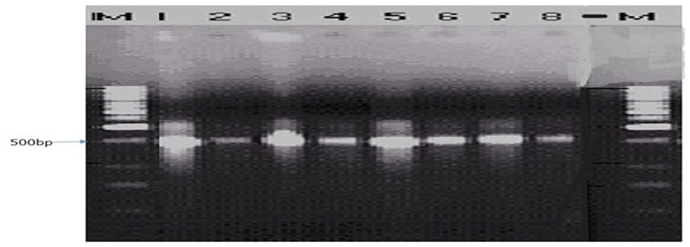 c3f108d4-c70e-41cb-a61b-faaf325c9b2b_figure4.gif